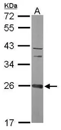 Anti-CCDC90B antibody [N1C2] used in Western Blot (WB). GTX119822