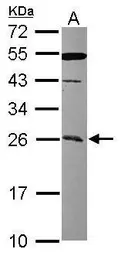 Anti-CCDC90B antibody [N1C2] used in Western Blot (WB). GTX119822
