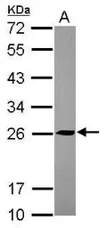 Anti-TMED5 antibody [N1C3] used in Western Blot (WB). GTX119825