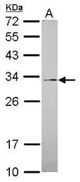 Anti-GALNT12 antibody [C1C3] used in Western Blot (WB). GTX119827