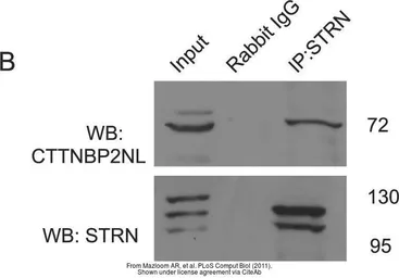 Anti-CTTNBP2NL antibody [N1N3] used in Western Blot (WB). GTX119828