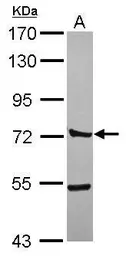 Anti-CTTNBP2NL antibody [N1N3] used in Western Blot (WB). GTX119828