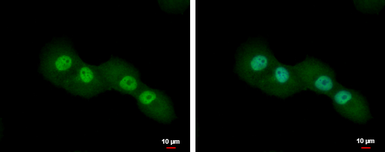 Anti-CUTC antibody [N1C2] used in Immunocytochemistry/ Immunofluorescence (ICC/IF). GTX119839