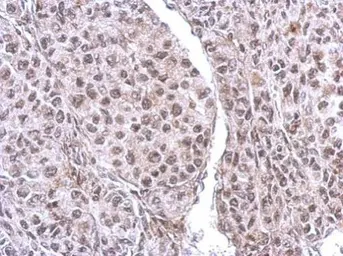Anti-CUTC antibody [N1C2] used in IHC (Paraffin sections) (IHC-P). GTX119839