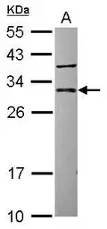 Anti-CUTC antibody [N1C2] used in Western Blot (WB). GTX119839