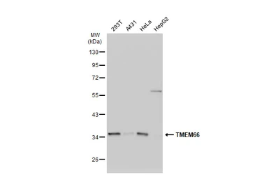 Anti-TMEM66 antibody used in Western Blot (WB). GTX119858