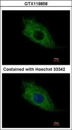 Anti-TMEM66 antibody used in Immunocytochemistry/ Immunofluorescence (ICC/IF). GTX119858