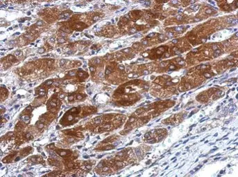 Anti-TMEM66 antibody used in IHC (Paraffin sections) (IHC-P). GTX119858