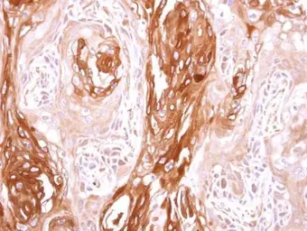 Anti-SEC23B antibody [N1N2], N-term used in IHC (Paraffin sections) (IHC-P). GTX119862