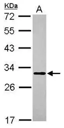 Anti-MTG1 antibody [N1C2] used in Western Blot (WB). GTX119864