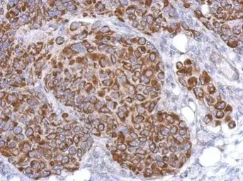 Anti-ARHGAP9 antibody used in IHC (Paraffin sections) (IHC-P). GTX119870
