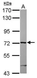 Anti-ARHGAP9 antibody used in Western Blot (WB). GTX119870