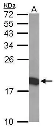 Anti-THOC7 antibody used in Western Blot (WB). GTX119877