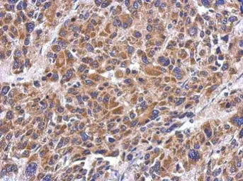 Anti-MRPS26 antibody [N1C3] used in IHC (Paraffin sections) (IHC-P). GTX119878