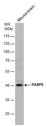 Anti-PABPC5 antibody [N1C2] used in Western Blot (WB). GTX119883
