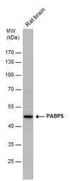 Anti-PABPC5 antibody [N1C2] used in Western Blot (WB). GTX119883