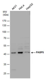 Anti-PABPC5 antibody [N1C2] used in Western Blot (WB). GTX119883