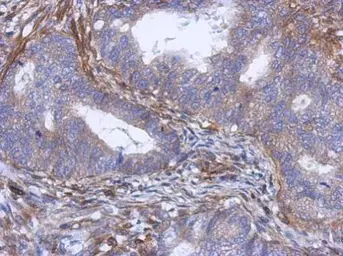 Anti-PABPC5 antibody [N1C2] used in IHC (Paraffin sections) (IHC-P). GTX119883