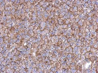 Anti-KIAA0090 antibody [N1N2], N-term used in IHC (Paraffin sections) (IHC-P). GTX119884