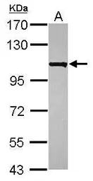 Anti-KIAA0090 antibody [N1N2], N-term used in Western Blot (WB). GTX119884