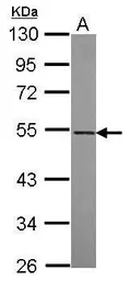 Anti-RASGEF1A antibody [N1C1] used in Western Blot (WB). GTX119891