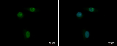 Anti-ANKRD23 antibody used in Immunocytochemistry/ Immunofluorescence (ICC/IF). GTX119905