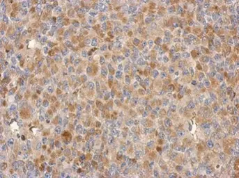 Anti-C18orf34 antibody [N1N2], N-term used in IHC (Paraffin sections) (IHC-P). GTX119924