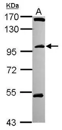 Anti-C18orf34 antibody [N1N2], N-term used in Western Blot (WB). GTX119924