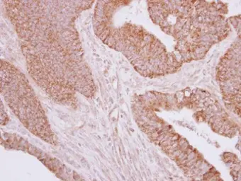 Anti-MOSC2 antibody [N1C3] used in IHC (Paraffin sections) (IHC-P). GTX119926