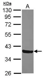 Anti-MOSC2 antibody [N1C3] used in Western Blot (WB). GTX119926