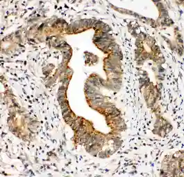 Anti-Integrin alpha 3 antibody used in IHC (Paraffin sections) (IHC-P). GTX11993