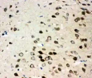 Anti-Integrin alpha 3 antibody used in IHC (Paraffin sections) (IHC-P). GTX11993