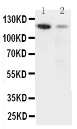 Anti-Integrin alpha 3 antibody used in Western Blot (WB). GTX11993