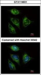 Anti-ABCF3 antibody [N1N3] used in Immunocytochemistry/ Immunofluorescence (ICC/IF). GTX119931
