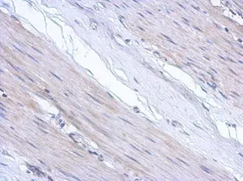 Anti-ABCF3 antibody [N1N3] used in IHC (Paraffin sections) (IHC-P). GTX119931