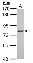 Anti-ABCF3 antibody [N1N3] used in Western Blot (WB). GTX119931