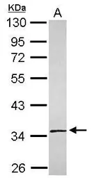 Anti-SLC25A36 antibody [N1C3] used in Western Blot (WB). GTX119934