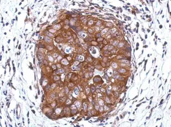 Anti-DCUN1D2 antibody [N2C3] used in IHC (Paraffin sections) (IHC-P). GTX119936