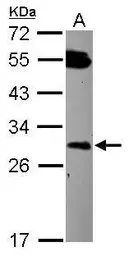 Anti-DCUN1D2 antibody [N2C3] used in Western Blot (WB). GTX119936
