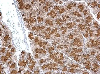 Anti-SYTL4 antibody used in IHC (Paraffin sections) (IHC-P). GTX119939