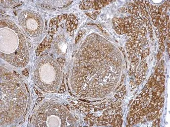 Anti-SYTL4 antibody used in IHC (Paraffin sections) (IHC-P). GTX119939