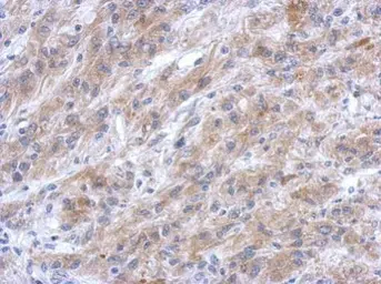 Anti-EFHC2 antibody [N1N3] used in IHC (Paraffin sections) (IHC-P). GTX119943