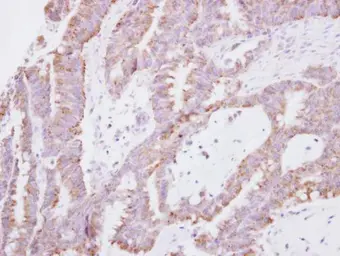 Anti-SNF8 antibody used in IHC (Paraffin sections) (IHC-P). GTX119948