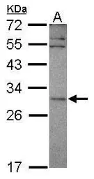 Anti-SNF8 antibody used in Western Blot (WB). GTX119948