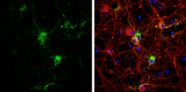 Anti-Syntabulin antibody used in Immunocytochemistry/ Immunofluorescence (ICC/IF). GTX119953