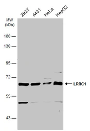 Anti-LRRC1 antibody used in Western Blot (WB). GTX119959
