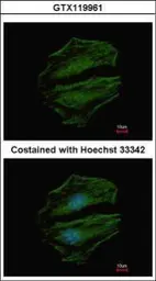 Anti-C8orf48 antibody used in Immunocytochemistry/ Immunofluorescence (ICC/IF). GTX119961