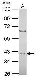 Anti-C8orf48 antibody used in Western Blot (WB). GTX119961
