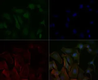 Anti-p73 delta N antibody [38C674.2] used in Immunocytochemistry/ Immunofluorescence (ICC/IF). GTX11997