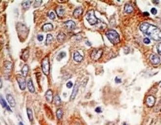 Anti-p73 delta N antibody [38C674.2] used in IHC (Paraffin sections) (IHC-P). GTX11997